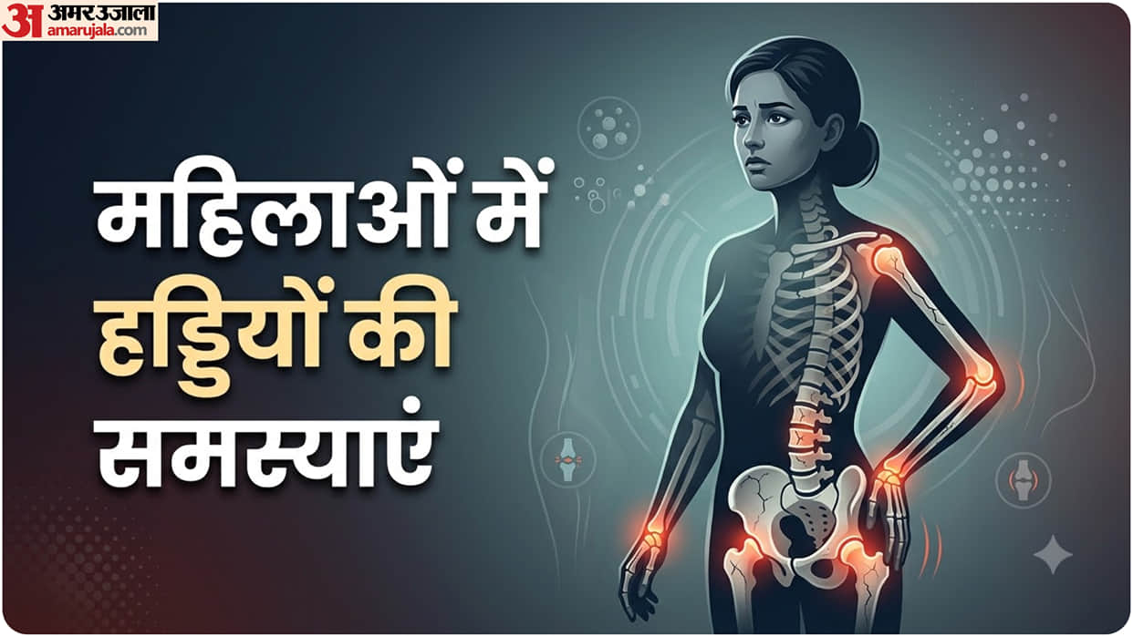 Why Women Are at Higher Risk of Osteoporosis Bone Loss After Menopause