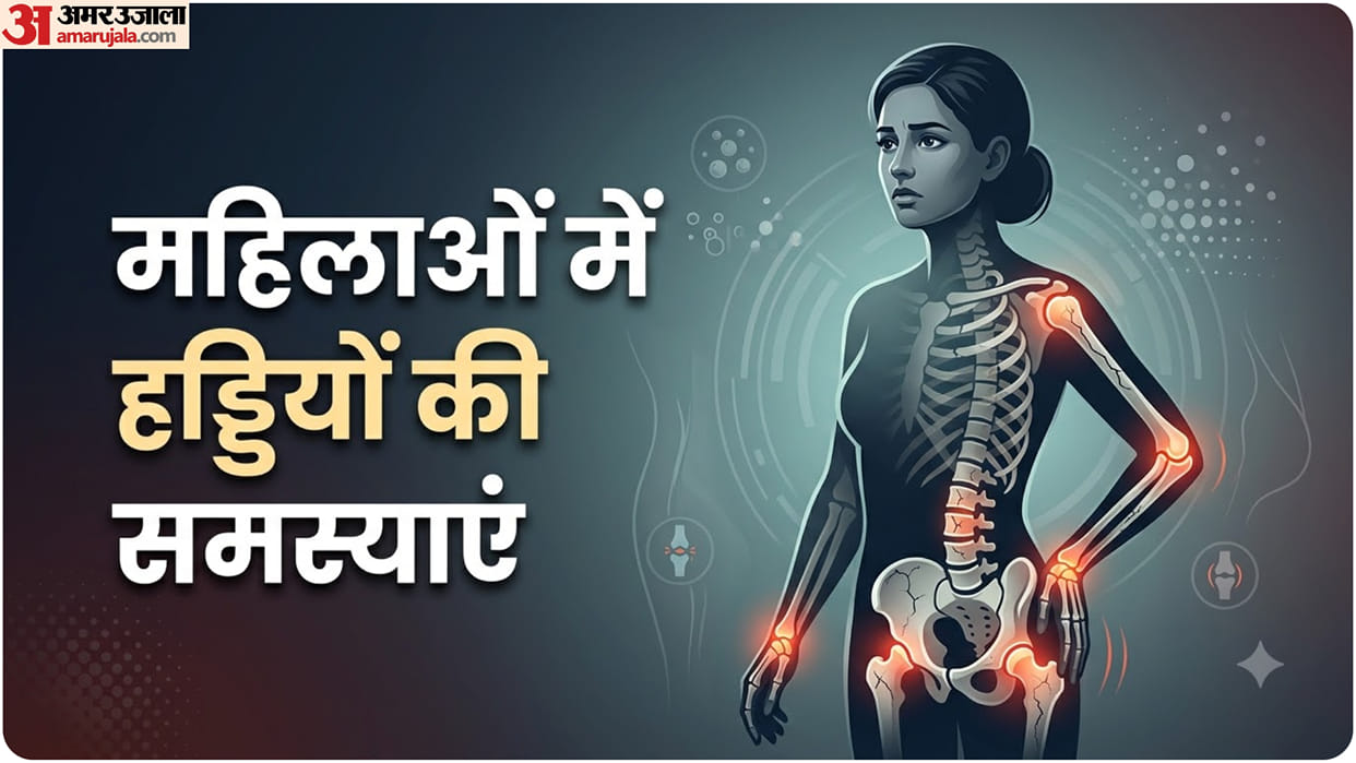 Why Women Are at Higher Risk of Osteoporosis Bone Loss After Menopause