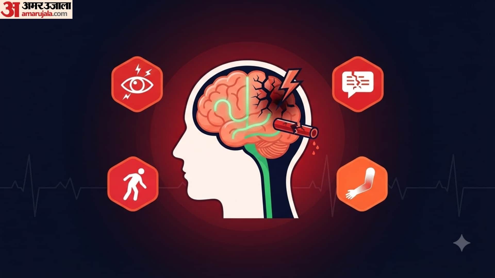 Every Minute Matters in stroke Warning Signs You Should Never Ignore
