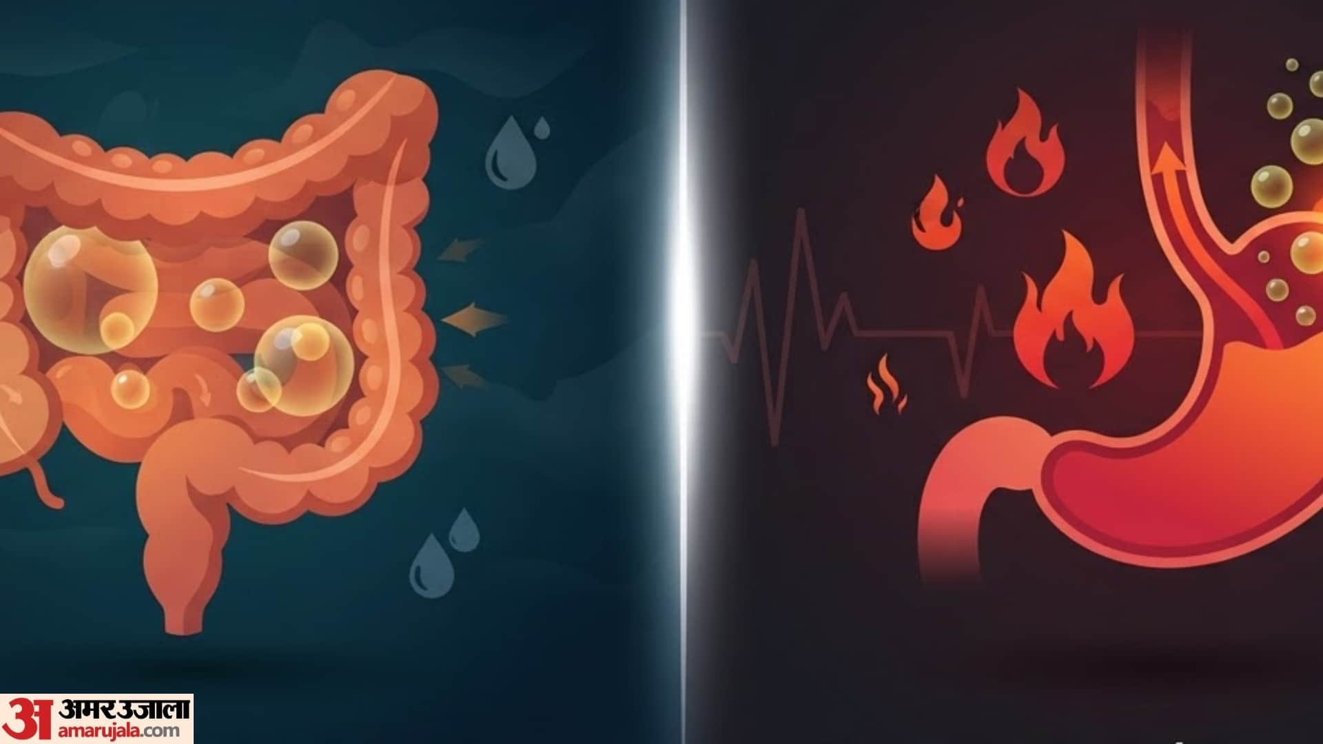 Common Causes of Post-Meal Acidity and Gas in hindi pet ki gas kaise theek karen gharelu upay