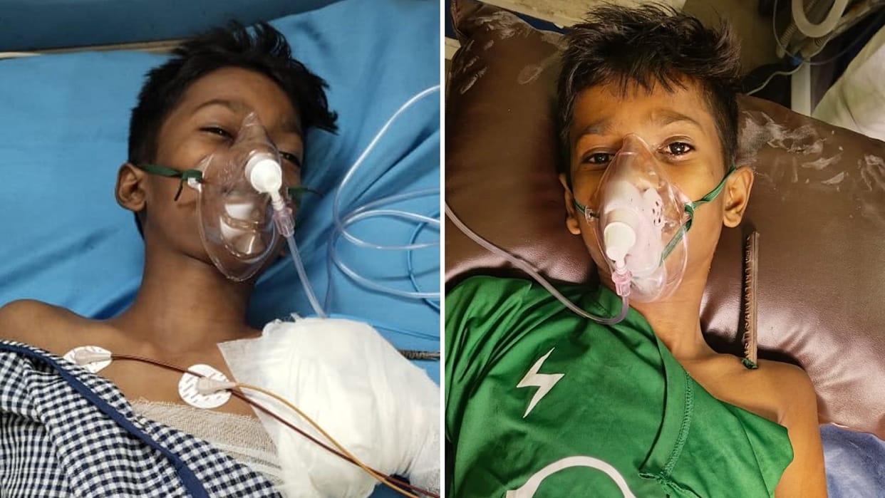 Iron rod pierces child body Horrific accident playing roof family rushed hearing screams ICU admit