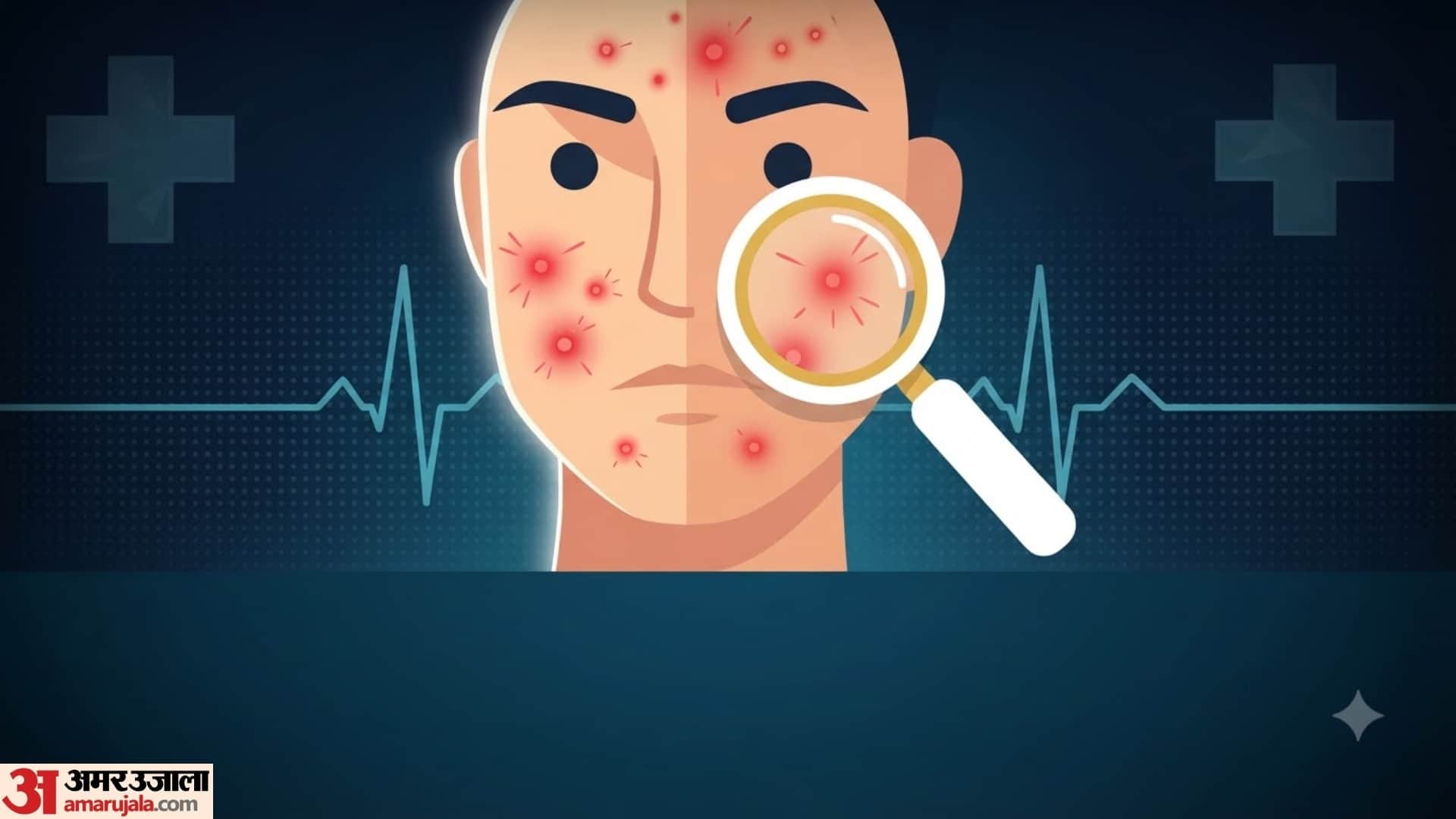 Main Causes of Sudden Facial Bumps in hindi chehre par dane nikal aye to kya kare disprj