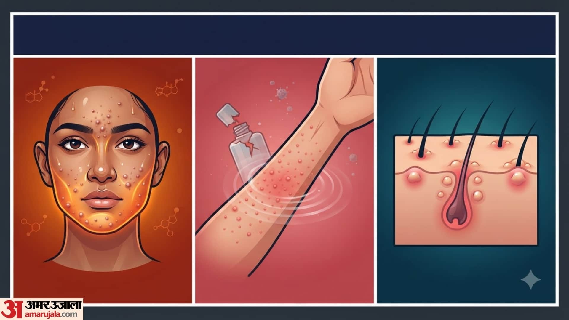 Main Causes of Sudden Facial Bumps in hindi chehre par dane nikal aye to kya kare disprj