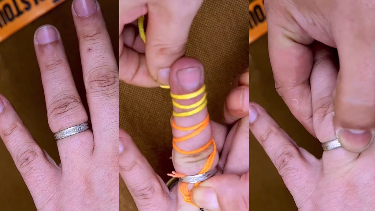 Desi jugaad to remove ring stuck on your finger using piece of thread viral video