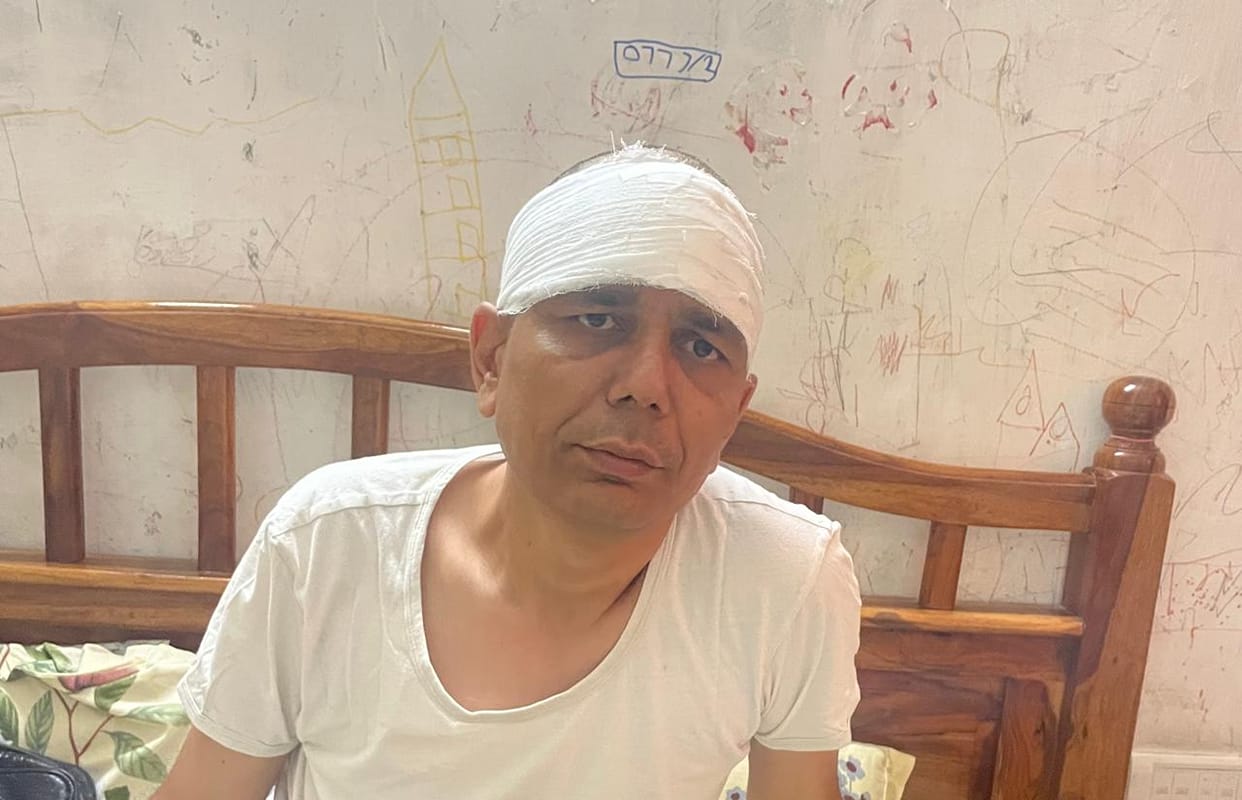 Government Officer Attacked Outside Home in Jaipur, 25 Stitches on Head; Attackers Still at Large