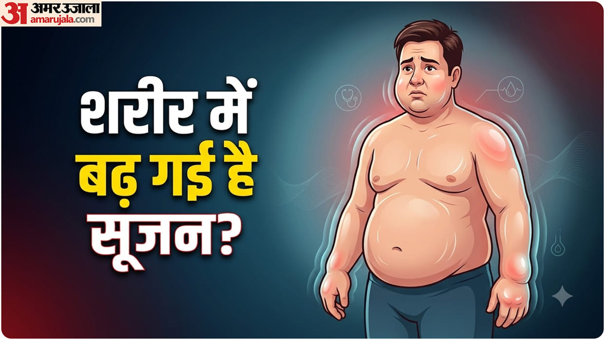 Edema vs Obesity Swollen Feet and Ankles Causes You Should know