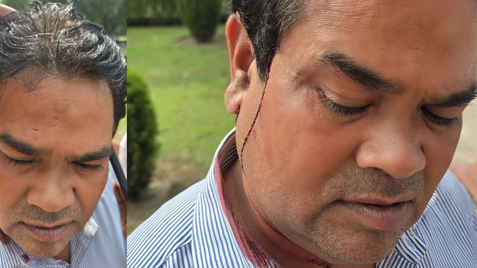 ताज पर झगड़ा: पर्यटक लपकने के चक्कर में भिड़ गए दो फोटोग्राफर, जमकर हुई मारपीट; एक हो गया गंभीर घायल