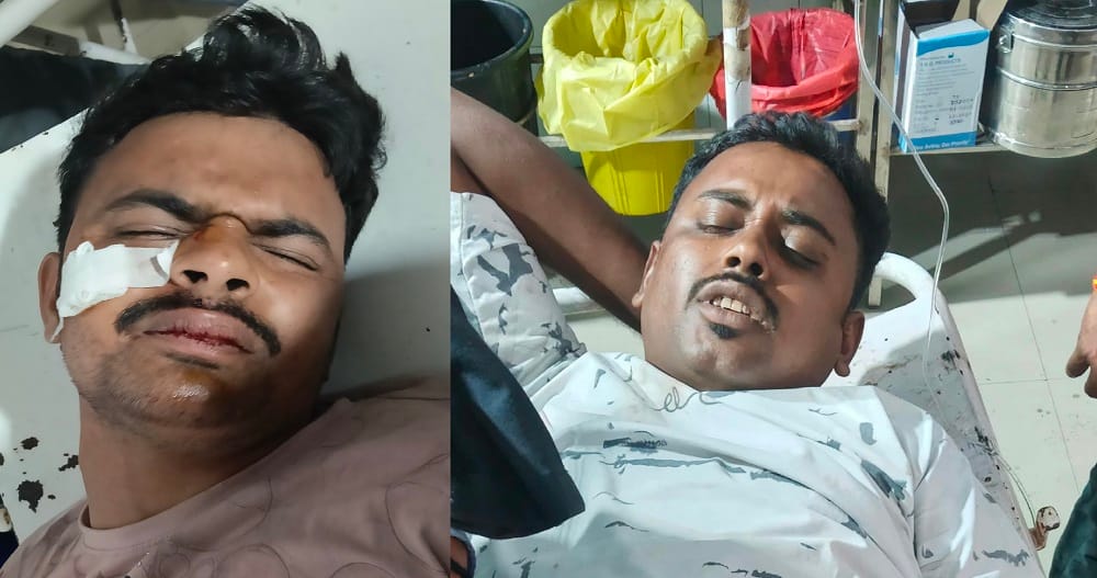 Kanpur Speeding bike rams into stationary truck two security guards injured left writhing in pain for an hour