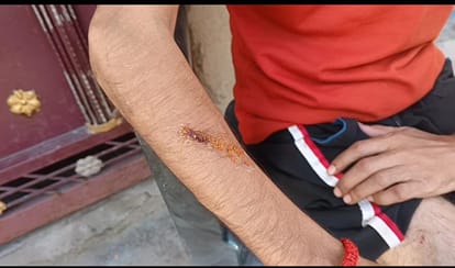 Stray dog menace in Kanpur Artisan knocked down and mauled while out to buy milk