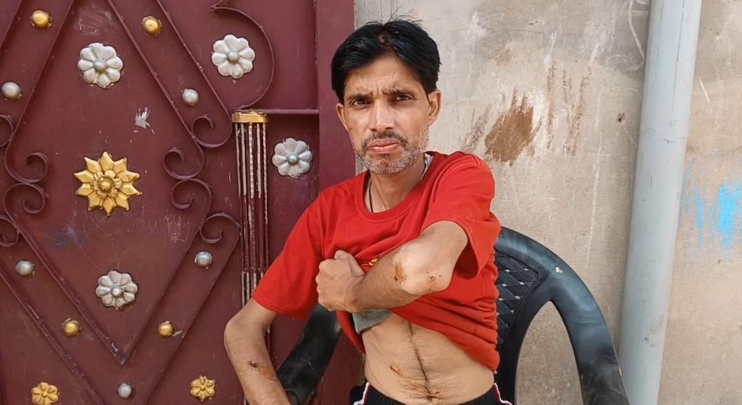 कानपुर में आवारा कुत्तों का आतंक: दूध लेने निकले कारीगर को गिराकर नोंचा, पांच दिन पहले मासूम पर किया था हमला