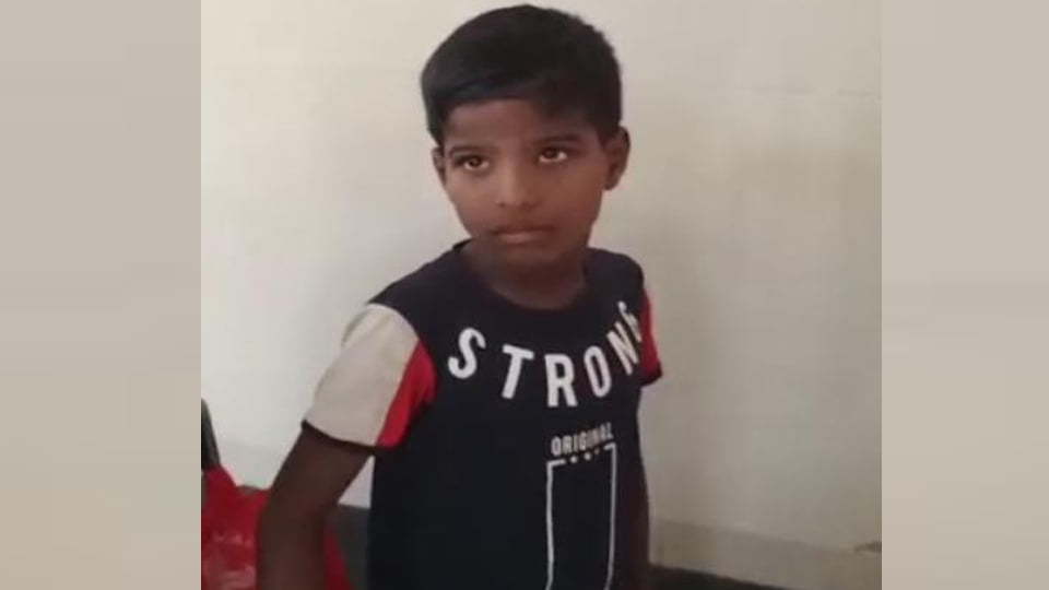 कानपुर: घर के बाहर खेल रहे बच्चे को कुत्ते ने नोचा, लहूलुहान, लोगों में दहशत का माहौल