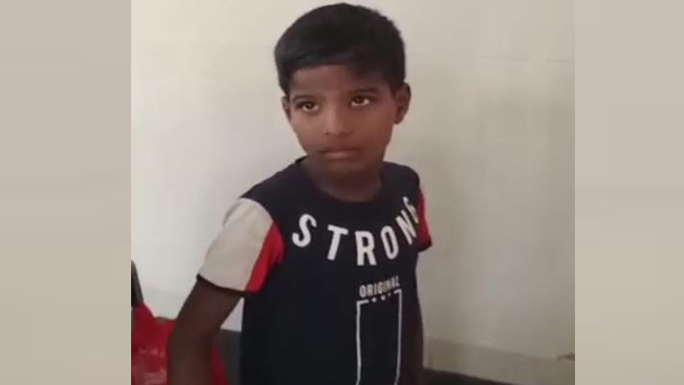 कुत्ते ने नौ वर्षीय बच्चे इरशाद पर किया हमला