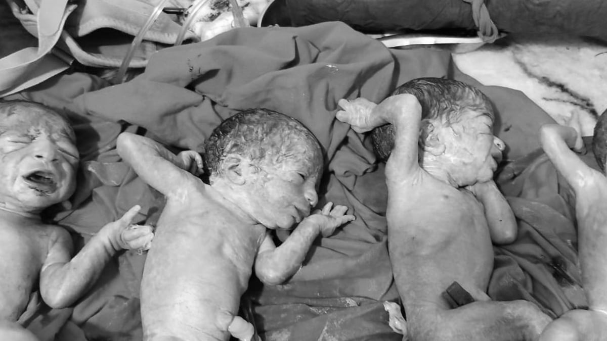 बरेली: निजी अस्पताल में महिला ने चार बच्चों को दिया जन्म, दो बेटे और दो बेटियां, चारों स्वस्थ