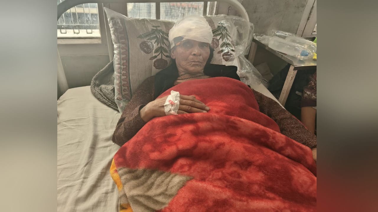 तेंदुए के हमले में घायल महिला अस्पताल में उपचाराधीन।