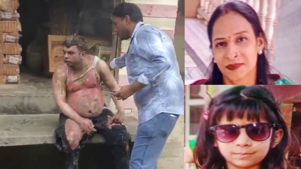आग से झुलसे अंकुर जैन और उनकी पत्नी व बेटी की फाइल फोटो।