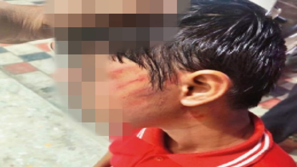 Bhopal: Class 5 Student Slapped for Not Completing Homework, Family Demands Coaching Teacher’s Arrest