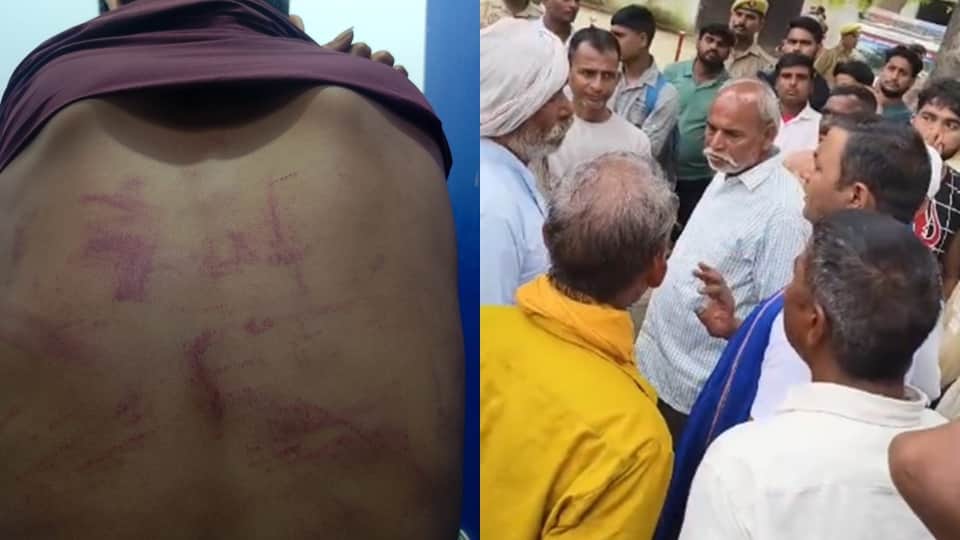 Assault case BJP MLA residence: Moradabad police investigation stalled for ten days; Ramu condition worsens