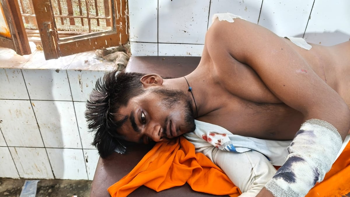 पीलीभीत: जंगल किनारे खेत पर गए युवक पर बाघ ने किया हमला, गंभीर रूप से घायल