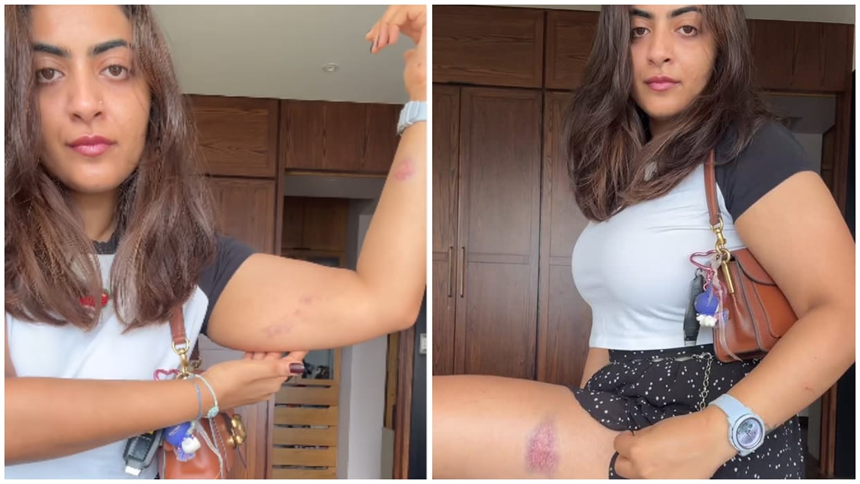 Aamir Khan Niece Zayn Marie Shows Injury Marks After Temporary Detention During Mumbai Protest