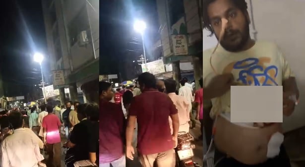 कानपुर गोलीकांड: हिस्ट्रीशीटरों ने मारपीट के बाद युवक को मारी गोली, पेट में गोली लगने से घायल, हैलट में भर्ती
