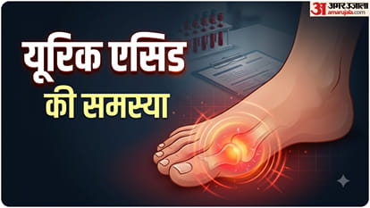 यूरिक एसिड की समस्याएं