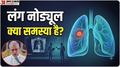 लंग नोड्यूल की समस्या