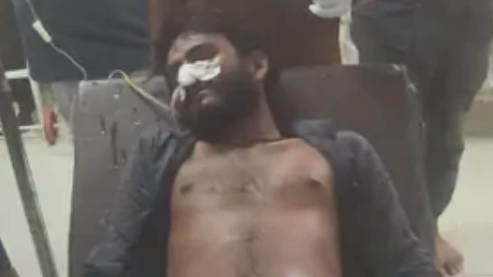 किसान को अस्पताल में भर्ती कराया गया है।