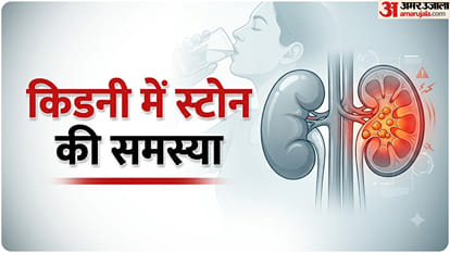 किडनी में स्टोन की समस्या