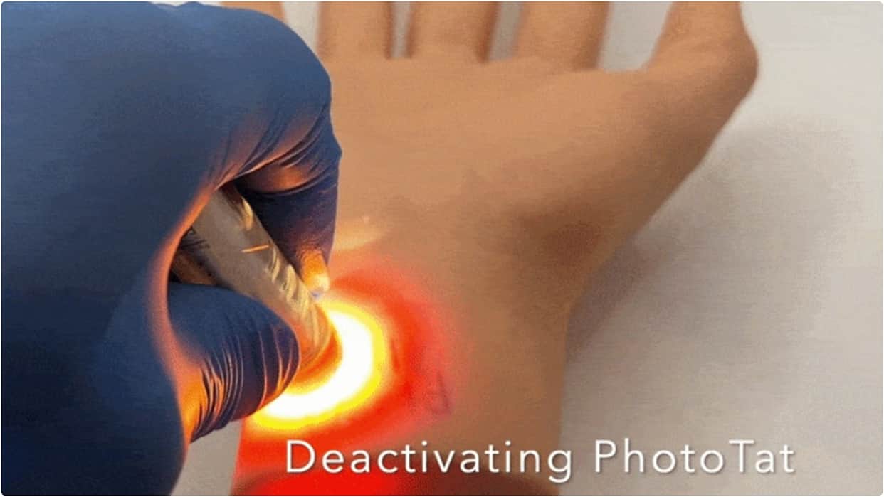 New technology: A tattoo will appear when light hits it and vanish when light is removed; medical treatments.
