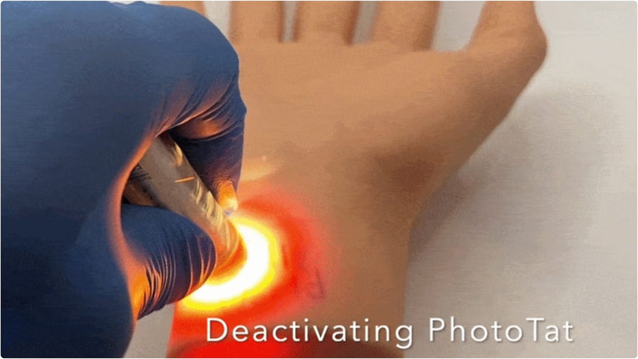 New technology: A tattoo will appear when light hits it and vanish when light is removed; medical treatments.