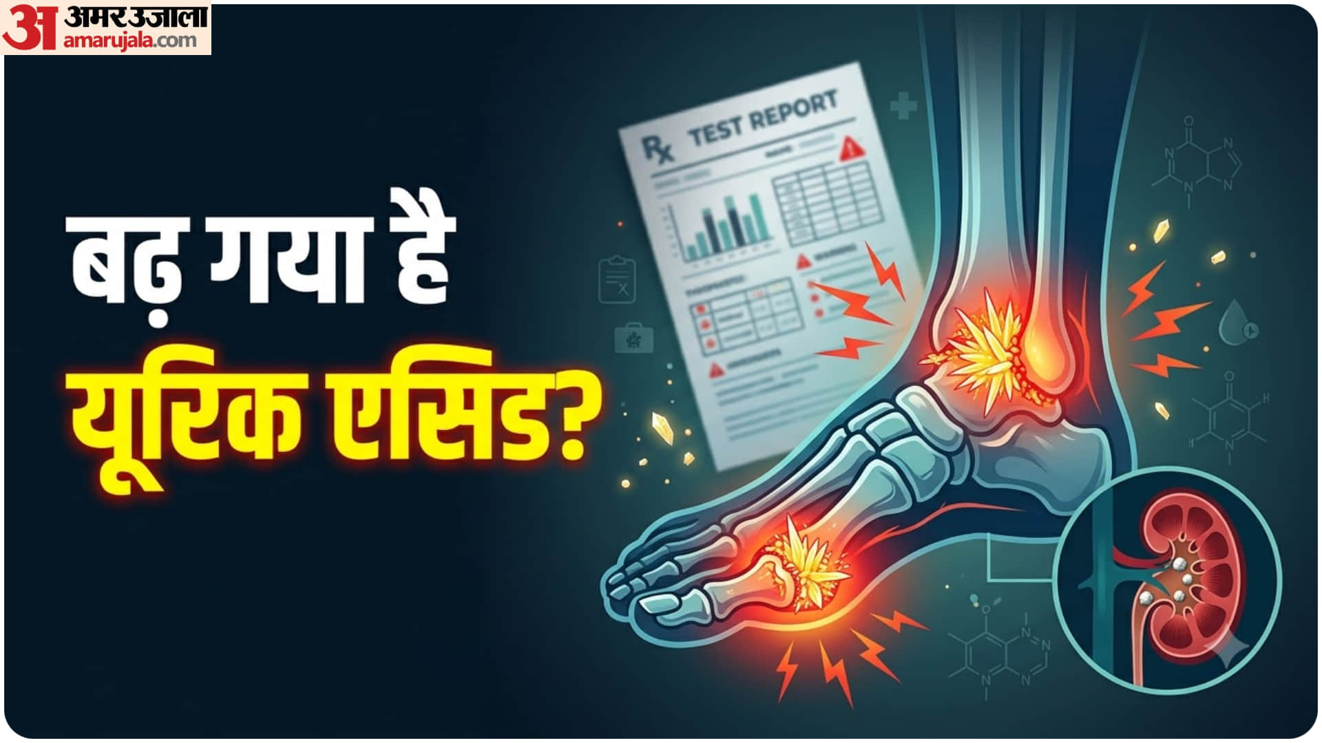 Where Does High Uric Acid Cause Pain in the Body High Uric Acid Symptoms