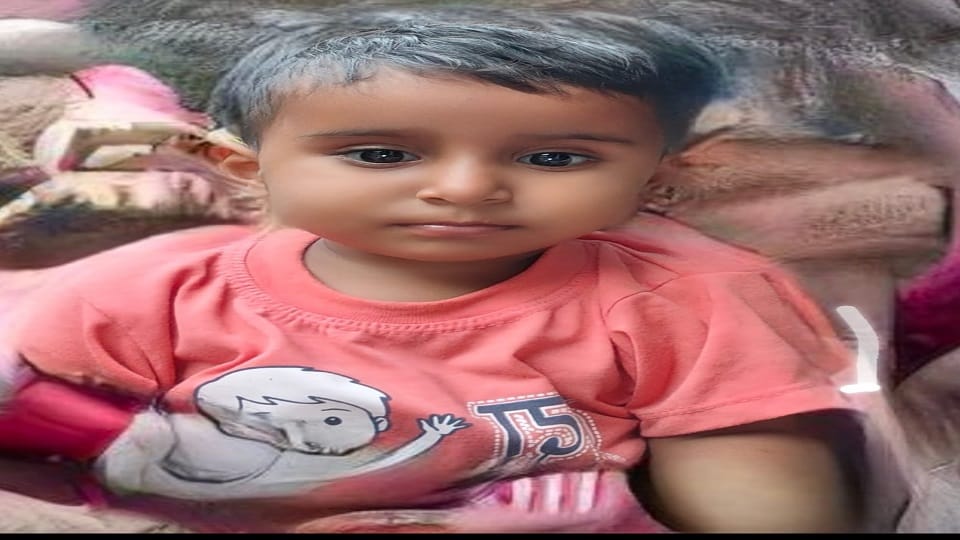 Girl dies after being burnt by hot milk