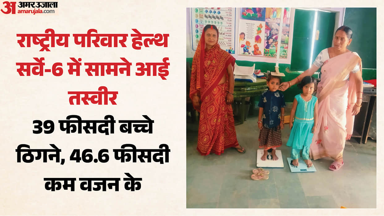 Levels of severe malnutrition improved childhood in Sonbhadra remains most vulnerable children stunted