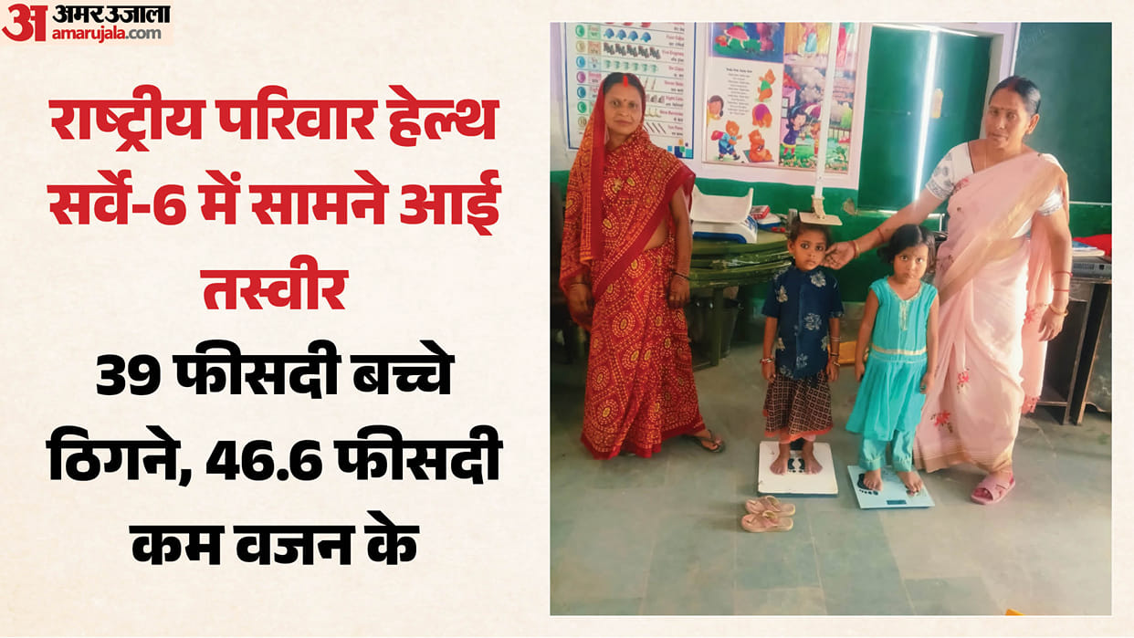 Levels of severe malnutrition improved childhood in Sonbhadra remains most vulnerable children stunted