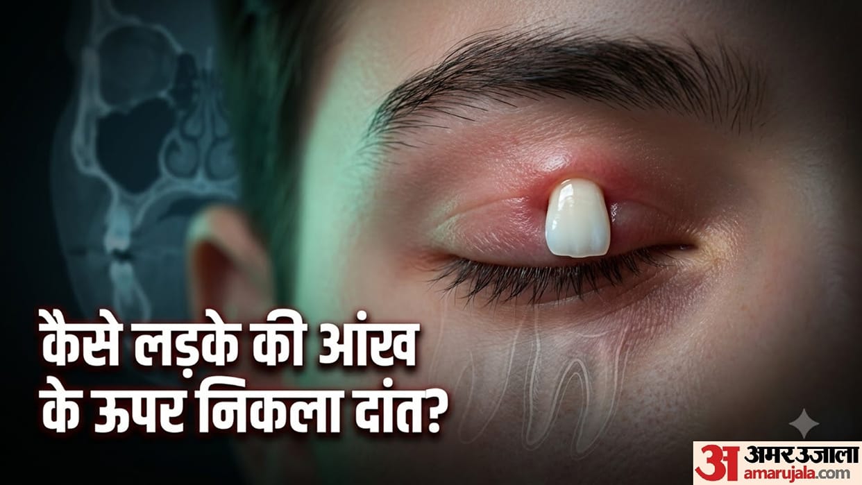 16 year old boy tooth above eye ectopic tooth rare medical case