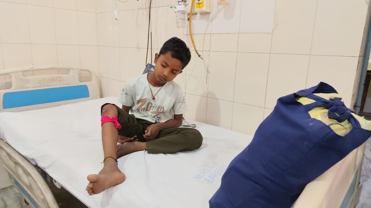 बरेली: कन्या भोज में जा रहे बालक पर कुत्ते ने किया हमला, पैर में दो जगह काटा