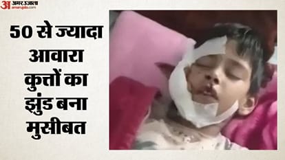 घायल बच्चा