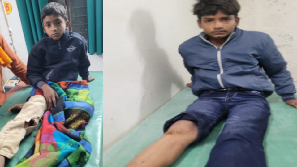 Bijnor: दशहरा मेला देखकर लौट रहे 3 किशोरों पर गुलदार का हमला, दो घायल; लक्की की सूझबूझ से बची जान
