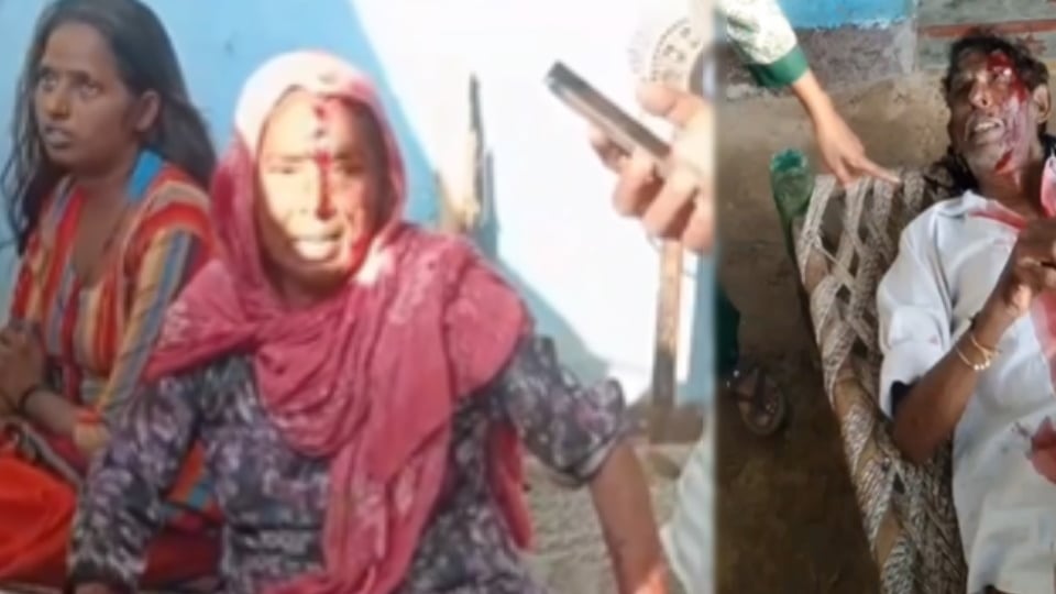 Baghpat: Four Injured in House Attack After Complaint Over Open Defecation, FIR Against Fourteen