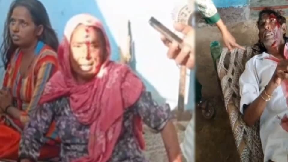 Baghpat: Four Injured in House Attack After Complaint Over Open Defecation, FIR Against Fourteen