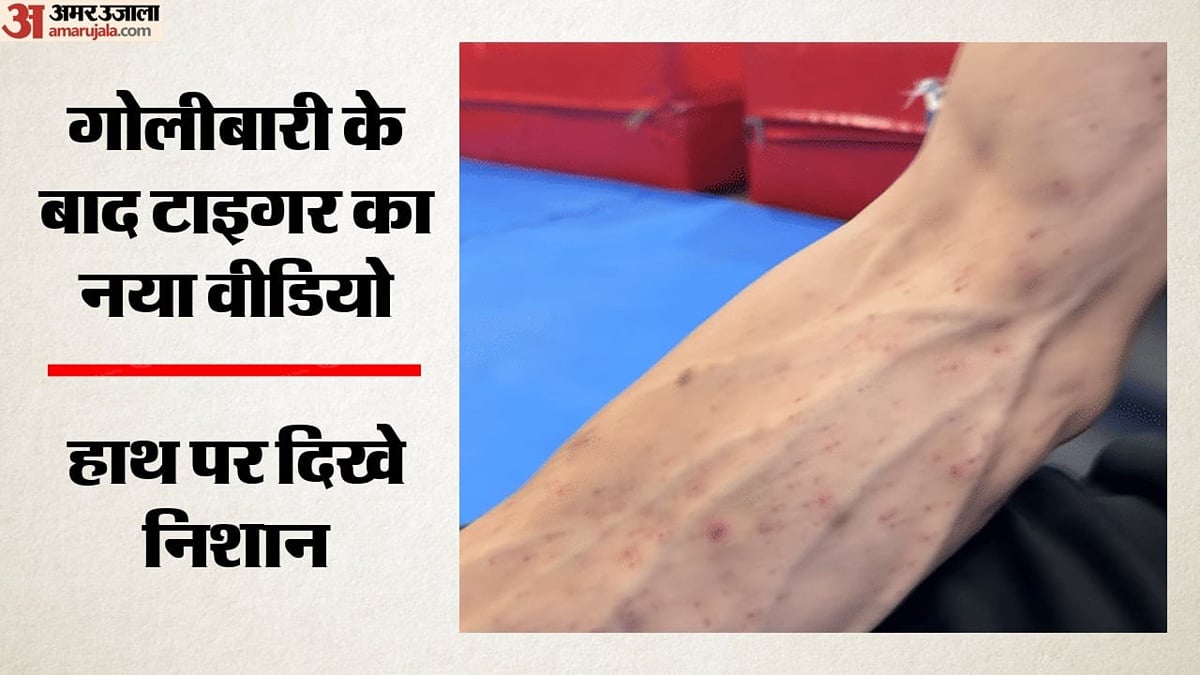 टाइगर श्रॉफ गोलीबारी मामला:                                   'भगवान दयालु हैं', टीम ने अभिनेता के घायल हाथ का वीडियो साझा किया; क्या कहा?