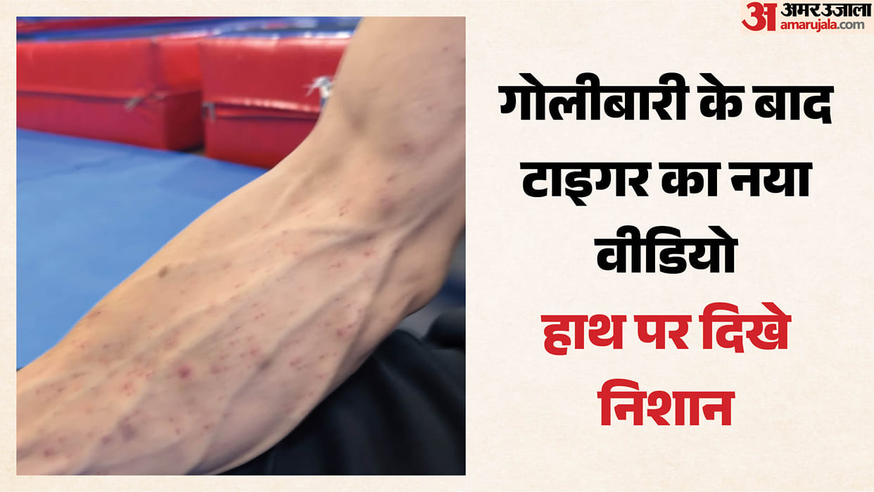Tiger Shroff firing case: Actor's team shared video of his injured arm, says 'God is kind'