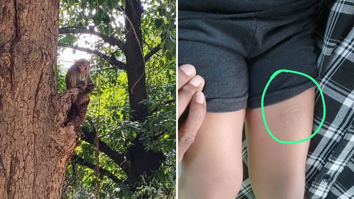 dogs monkey menace Four people innocent young girl bitten colony residents left terrified 500 victims hospital