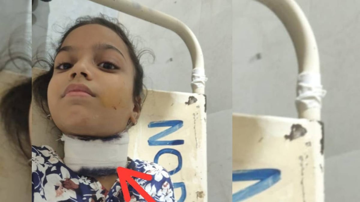 लखनऊ: खतरनाक मांझे ने रेता नौ वर्षीय बच्ची का गला, पिता के साथ बाइक पर जा रही थी