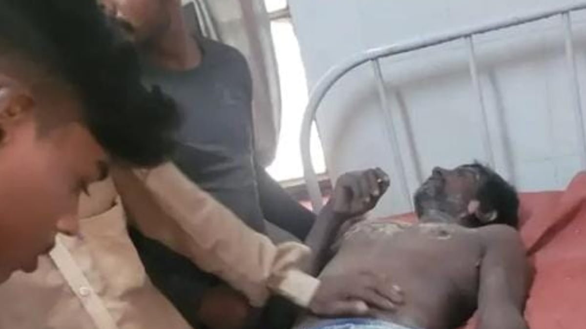 बरेली: जाल बांधते समय हाईटेंशन लाइन से टकराया सरिया, करंट लगने से दो मजदूर झुलसे