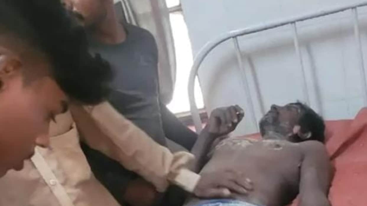 Two laborers suffered burns after coming into contact with a high-tension line in Bareilly