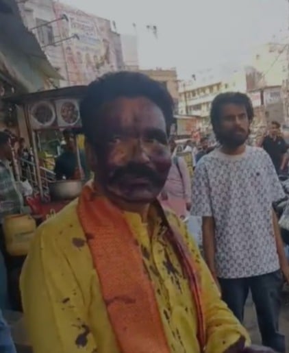 भोपाल: हिंदू उत्सव समिति अध्यक्ष के चेहरे पर पोती स्याही, जातिसूचक टिप्पणी के आरोप के बाद बढ़ा विवाद