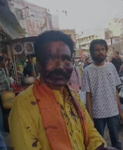 Bhopal: Ink smeared on face of Hindu Utsav Samiti president; controversy escalates following allegations of ca