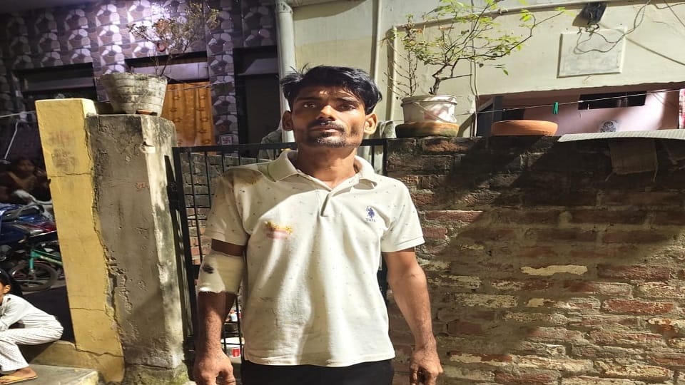 Couple crushed by vehicle and pregnant woman dies in Agra