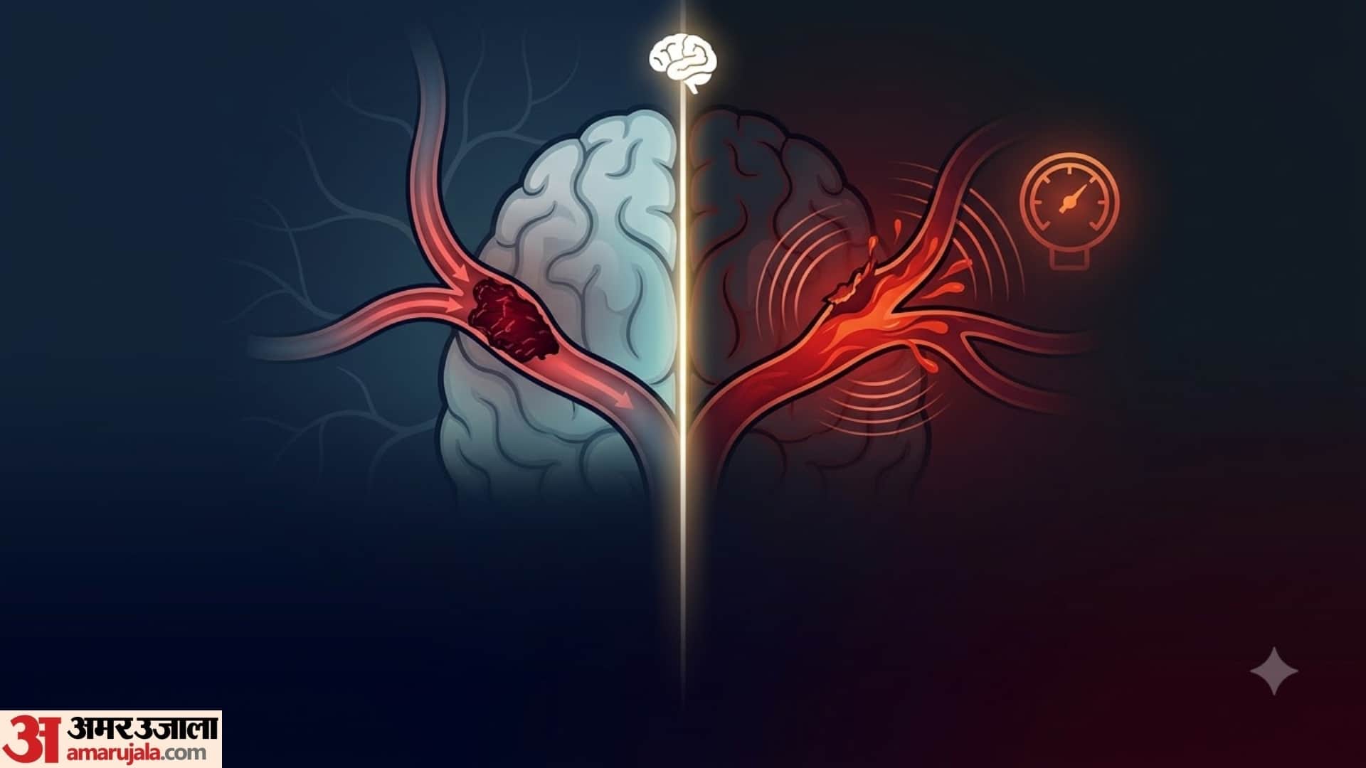 World Stroke Day 2026  Early Warning Signs of Stroke You Should Never Ignore
